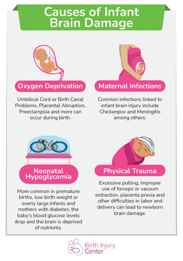 Causes of infant brain damage infographic