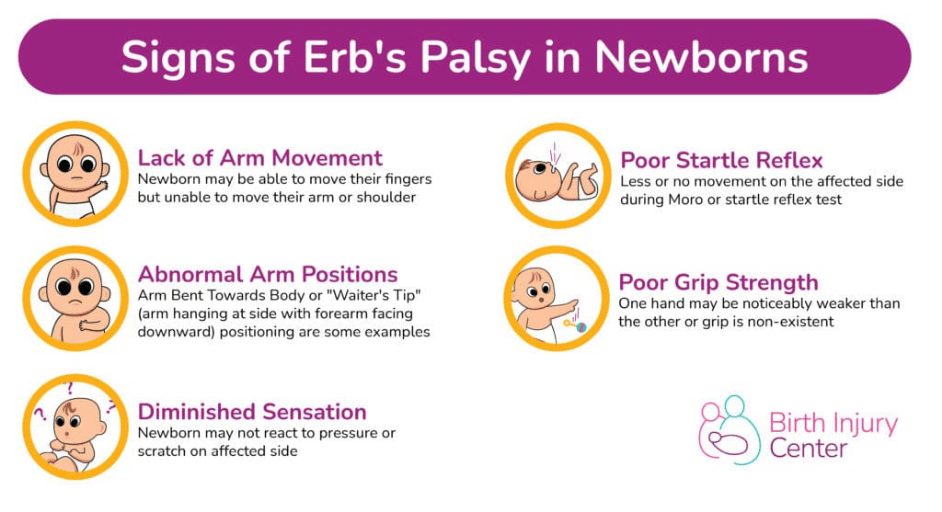 Signs of erb's palsy in newborns infographic